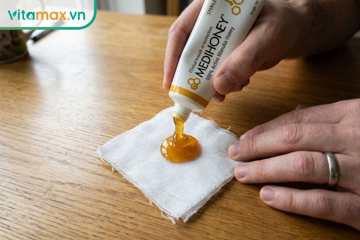 Hướng dẫn cách thấm mật ong lên miếng gạc vô trùng trước khi đắp lên vết bỏng để đảm bảo vệ sinh và tránh nhiễm trùng.