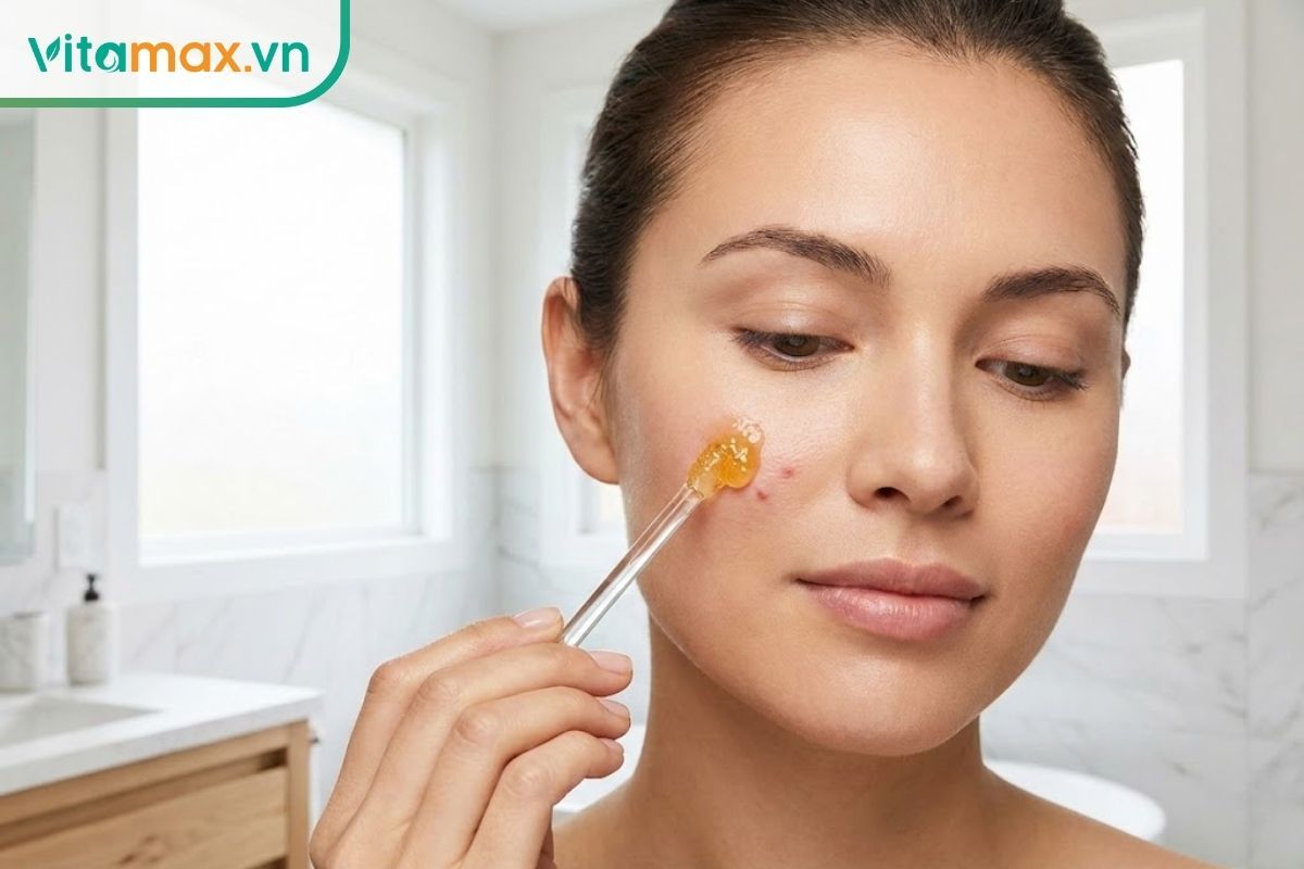 Người phụ nữ đang chấm mật ong Manuka lên nốt mụn viêm trên mặt để hỗ trợ giảm sưng và tái tạo da.