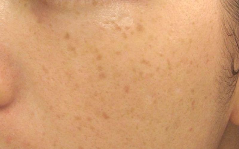 tác dụng của nhân sâm với da