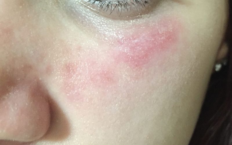 tác dụng của nhân sâm với da