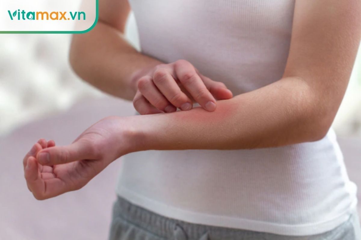 Người dị ứng với nhựa thông không nên uống tinh dầu thông đỏ